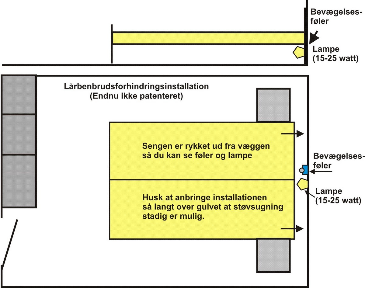 Automatisk%20underlys%20til%20sengen/L%E5rbensbrudsmodvirkningsforanstaltning-1..jpg